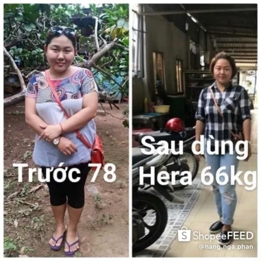 Trà thảo mộc giảm cân Hera - Giảm cân nhanh, an toàn, chỉ 500.000₫