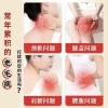 Túi 200 miếng cao dán nóng Ngải Cứu giảm đau xương khớp, vai gáy, tự nhiên 6