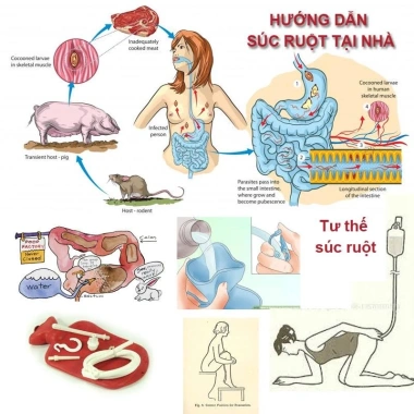 Túi Truyền Enema Cà Phê Thải Độc Đại Tràng PT Medical 1.200ml Giá 15.000 VND