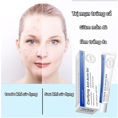Tuýp kem chấm mụn mờ thâm 18g không Paraben, kiểm soát lỗ chân lông - 149.000₫ 3