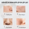 UNO Bộ 3 món làm sạch da nam - Kiểm soát dầu, dưỡng ẩm, Đen Xanh lá Xanh dương, 300k 7