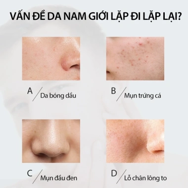UNO Bộ 3 món làm sạch da nam - Kiểm soát dầu, dưỡng ẩm, Đen Xanh lá Xanh dương, 300k