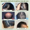 USMA Nature Dầu Gội Thảo Mộc Tân Cương Cỏ - Chống Rụng Gãy Xơ, Dưỡng ẩm Cho Nam Nữ, Giảm Giá 119.000 VND 6