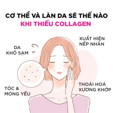 Viên Uống Collagen DHC Nhật Bản 30 Ngày - Da Sáng Căng Mịn, Chống Lão Hóa, 265.000 VND