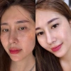 Viên Uống Vitamin C Eundan Trắng Da, Chống Nắng, Giảm Rụng Tóc, Collagen 399k 4