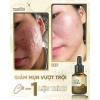 Vita Peel DR.LACIR Tinh Chất Detox Da 50ml Trẻ Hóa Da Sáng Mịn Giá Ưu Đãi 385.000₫ 4