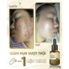 Vita Peel DR.LACIR Tinh Chất Detox Da 50ml Trẻ Hóa Da Sáng Mịn Giá Ưu Đãi 385.000₫ 5