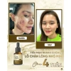 Vita Peel DR.LACIR Tinh Chất Detox Da 50ml Trẻ Hóa Da Sáng Mịn Giá Ưu Đãi 385.000₫ 7