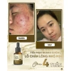 Vita Peel DR.LACIR Tinh Chất Detox Da 50ml Trẻ Hóa Da Sáng Mịn Giá Ưu Đãi 385.000₫ 8