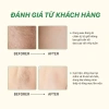 Wax lông UMIHA 95gr - Sáp bám dính x2 + Vitamin C, sáng da, giảm còn 175.000₫ 6