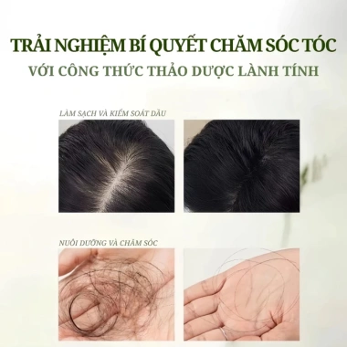 Xà Phòng Gội Đầu Cỏ Tân Cương Thảo Dược Tự Nhiên – Giảm Dầu, Ngừa Rụng Tóc, An Toàn Lành Tính Cho Da Đầu – Chỉ 81.770₫ 7 Xà Phòng Gội Đầu Cỏ Tân Cương Thảo Dược Tự Nhiên – Giảm Dầu, Ngừa Rụng Tóc, An Toàn Lành Tính Cho Da Đầu – Chỉ 81.770₫ 7