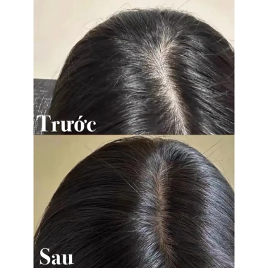 Xà phòng gội đầu thảo dược Usma Tân Cương giảm dầu, ngăn ngừa rụng tóc - Chính hãng 69.000₫ 2