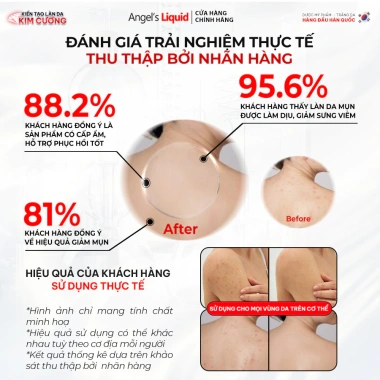 Xịt Angel's Liquid Glutathione+ Spot Care 150ml Hàn Quốc - Cải thiện mụn lưng, mờ thâm sau mụn, giảm giá 22% 7 Xịt Angel's Liquid Glutathione+ Spot Care 150ml Hàn Quốc - Cải thiện mụn lưng, mờ thâm sau mụn, giảm giá 22% 7