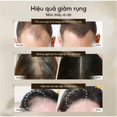 Xịt dưỡng tóc Lab on Hair - Giảm rụng tóc, tăng độ dày, chỉ 128.000₫ 3