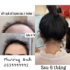 Xịt dưỡng tóc Tinh dầu bưởi Hoàng Cầm - Dưỡng ẩm, bóng mượt, giảm rụng, giá chỉ 88.000đ 3