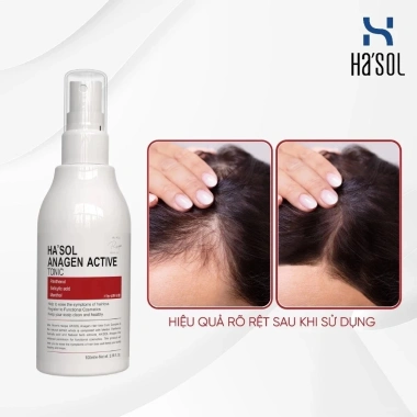 Xịt Kích Mọc Tóc Hasol Anagen Active 100ml - Dưỡng Da Đầu, Nuôi Dưỡng Nang Tóc Chắc Khỏe, Giảm Giá 324.000 5