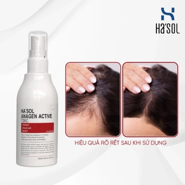 Xịt Kích Mọc Tóc Hasol Anagen Active 100ml Dưỡng Da Đầu, Nuôi Dưỡng Nang Tóc Chắc Tóc Rụng Mỏng Yếu, Giảm Giá 312k 5