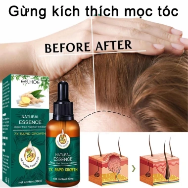 Xịt Mọc Tóc Gừng 7 Ngày 30ml - Dưỡng tinh dầu, phục hồi hư tổn, giảm gãy rụng, kích thích tóc nhanh 4 Xịt Mọc Tóc Gừng 7 Ngày 30ml - Dưỡng tinh dầu, phục hồi hư tổn, giảm gãy rụng, kích thích tóc nhanh 4