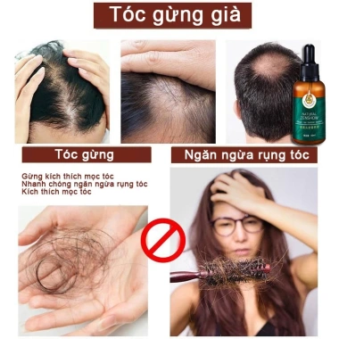 Xịt Mọc Tóc Gừng 7 Ngày 30ml - Dưỡng tinh dầu, phục hồi hư tổn, giảm gãy rụng, kích thích tóc nhanh 5 Xịt Mọc Tóc Gừng 7 Ngày 30ml - Dưỡng tinh dầu, phục hồi hư tổn, giảm gãy rụng, kích thích tóc nhanh 5
