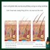 Xịt Mọc Tóc Gừng 7 Ngày 30ml - Dưỡng tinh dầu, phục hồi hư tổn, giảm gãy rụng, kích thích tóc nhanh 6