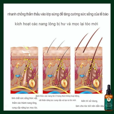 Xịt Mọc Tóc Gừng 7 Ngày 30ml - Dưỡng tinh dầu, phục hồi hư tổn, giảm gãy rụng, kích thích tóc nhanh