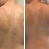 Xịt mụn lưng Skin Fresh AHA và Niacinamide - Giá 60k, se khít lỗ chân lông 6