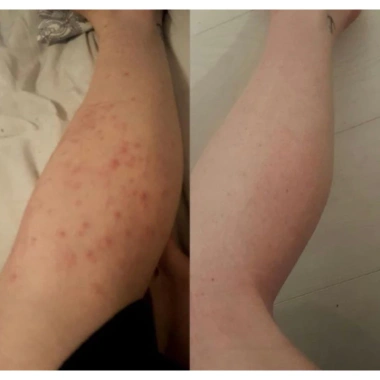 Xịt mụn lưng Skin Fresh AHA và Niacinamide - Giá 60k, se khít lỗ chân lông