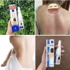Xịt Mụn Lưng Thái Lan Vitara SE Gel - Giảm Mụn, Mờ Thâm, Dưỡng Da, Giá 295.000đ 2