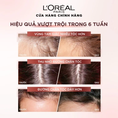Xịt serum L'Oreal Full Resist Anti Hairfall 90ml Ngăn gãy rụng tóc, 299.000đ 6 Xịt serum L'Oreal Full Resist Anti Hairfall 90ml Ngăn gãy rụng tóc, 299.000đ 6