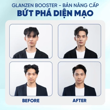 Xịt tạo phồng GLANZEN Booster Premium 2.025 200ml - Dành cho tóc mỏng, xẹp, giảm 22%