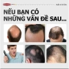 Xịt Tóc HAIR CARE ESSENCE 30ml - Mọc tóc chắc khỏe, giảm rụng, dày tóc Baoquyenstore 5