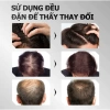 Xịt Tóc HAIR CARE ESSENCE 30ml - Mọc tóc chắc khỏe, giảm rụng, dày tóc Baoquyenstore 6
