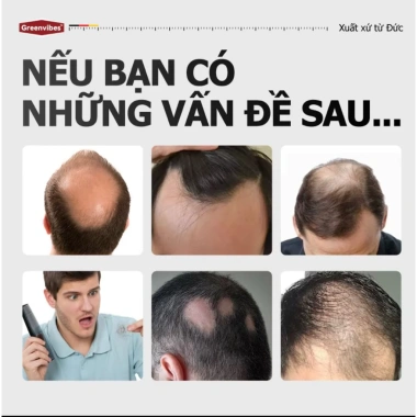 Xịt Tóc Kích Thích Nang, Giảm Rụng, Hỗ Trợ Mọc Chắc Khỏe - Essence 65.000 VND 3