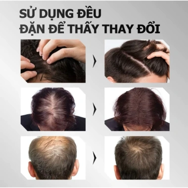 Xịt Tóc Kích Thích Nang, Giảm Rụng, Hỗ Trợ Mọc Chắc Khỏe - Essence 65.000 VND 7