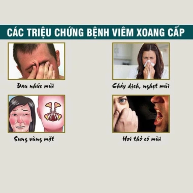 Xịt Xoang Nazal Nhật Bản Giảm Ngạt Mũi, Dị Ứng Thời Tiết, Chảy Mũi Hiệu Quả 3