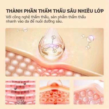 Xoa Bóp Xương Khớp Li Shi Zhen Miao 3 Hủ Giảm Đau Cổ Vai Gáy Lưng Giá 109.000₫