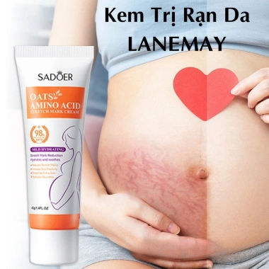 Xoài Xóa Sẹo & Kem Rạn Da 40g Dành Cho Bà Bầu – Giảm 42k, Làm Săn Chắc Sau Sinh 3 Xoài Xóa Sẹo & Kem Rạn Da 40g Dành Cho Bà Bầu – Giảm 42k, Làm Săn Chắc Sau Sinh 3