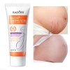 Xoài Xóa Sẹo & Kem Rạn Da 40g Dành Cho Bà Bầu – Giảm 42k, Làm Săn Chắc Sau Sinh 10