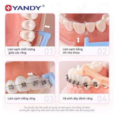 YANDY Bàn Chải Kẽ Răng Hình L - Làm Sạch Sâu Giữa Răng, Chỉnh Nha, Chính Hãng, 60.000₫ 4 YANDY Bàn Chải Kẽ Răng Hình L - Làm Sạch Sâu Giữa Răng, Chỉnh Nha, Chính Hãng, 60.000₫ 4