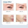 10 Mặt nạ B5 BIOSKIN Hàn Quốc - Dưỡng ẩm sâu, chống lão hoá, hồi da, giảm kích ứng, giá 20.600 VND 8