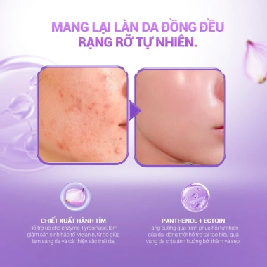 2 Hộp Mặt Nạ KEYSHU Sợi Xơ Rau Má & Hành Tím Dưỡng ẩm, Làm mềm da, Ngừa lão hoá 430.000₫ 6