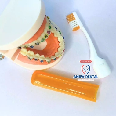 Bàn Chải Chỉnh Nha Gấp Gọn Lông Chữ V - Tiện Lợi, Vệ Sinh, Chuẩn Nha Khoa, Giá 29.000đ