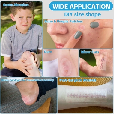 Băng Hydrocolloid cấp y tế cực lớn tự dính, siêu thấm, không thấm nước - Bộ sơ cứu DIY