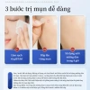 Bộ 36 miếng dán mụn Hydrocolloid TJT - Giảm sưng nhanh, không thấm nước, che mụn hiệu quả, 13.500đ 3