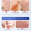 Bộ 36 miếng dán mụn Hydrocolloid TJT - Giảm sưng nhanh, không thấm nước, che mụn hiệu quả, 13.500đ 4