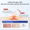 Bộ 36 miếng dán mụn Hydrocolloid TJT - Giảm sưng nhanh, không thấm nước, che mụn hiệu quả, 13.500đ 5