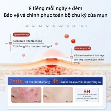 Bộ 36 miếng dán mụn Hydrocolloid TJT - Giảm sưng nhanh, không thấm nước, che mụn hiệu quả, 13.500đ 5 Bộ 36 miếng dán mụn Hydrocolloid TJT - Giảm sưng nhanh, không thấm nước, che mụn hiệu quả, 13.500đ 5