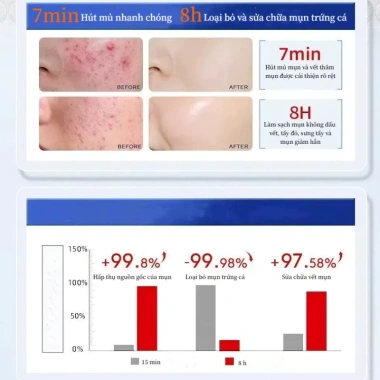Bộ 36 miếng dán mụn Hydrocolloid TJT - Giảm sưng nhanh, không thấm nước, che mụn hiệu quả, 13.500đ