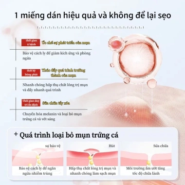 Bộ 36 miếng dán mụn Hydrocolloid TJT - Giảm sưng nhanh, không thấm nước, che mụn hiệu quả, 13.500đ 7 Bộ 36 miếng dán mụn Hydrocolloid TJT - Giảm sưng nhanh, không thấm nước, che mụn hiệu quả, 13.500đ 7