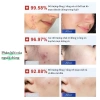 Bộ 36 miếng dán mụn Hydrocolloid TJT - Giảm sưng nhanh, không thấm nước, che mụn hiệu quả, 13.500đ 9